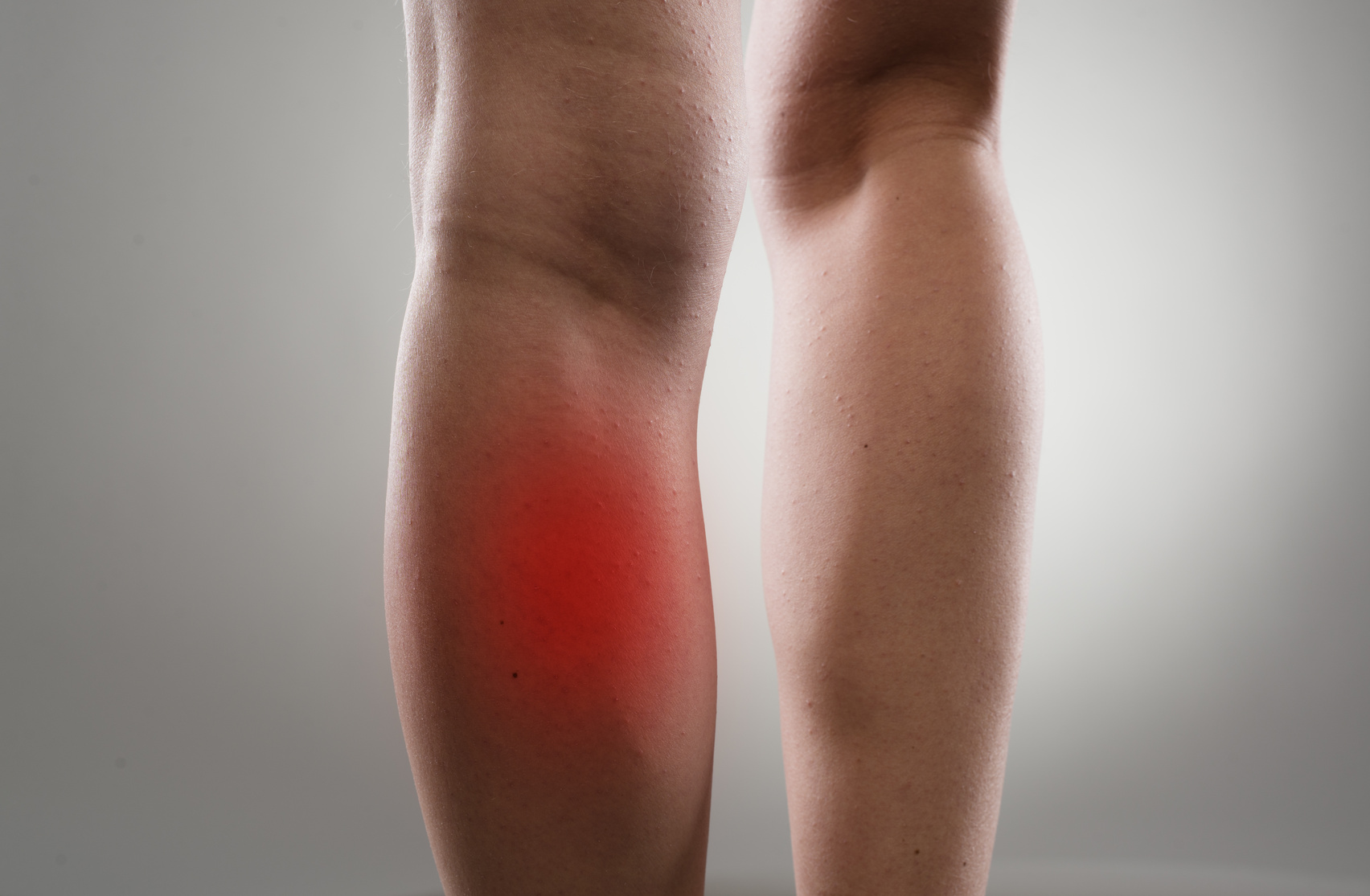 Rotura de fibras en gemelo: ¿fragilidad muscular o problema circulatorio oculto?