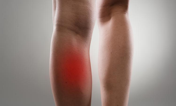 Rotura de fibras en gemelo: ¿fragilidad muscular o problema circulatorio oculto?